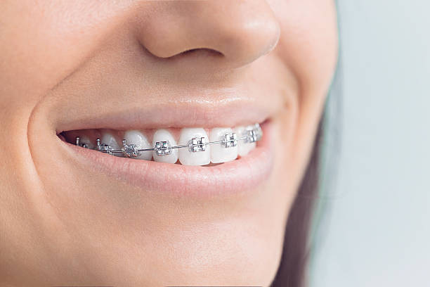 Best Invisalign and Clear Aligners  in Crandall, TX